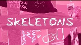 Обложка клипа Skeletons